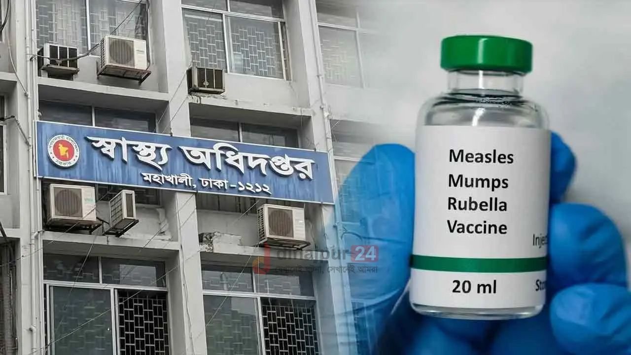 হাম ও উপসর্গে আরো ১১ শিশুর মৃত্যু, মোট ৪০৯