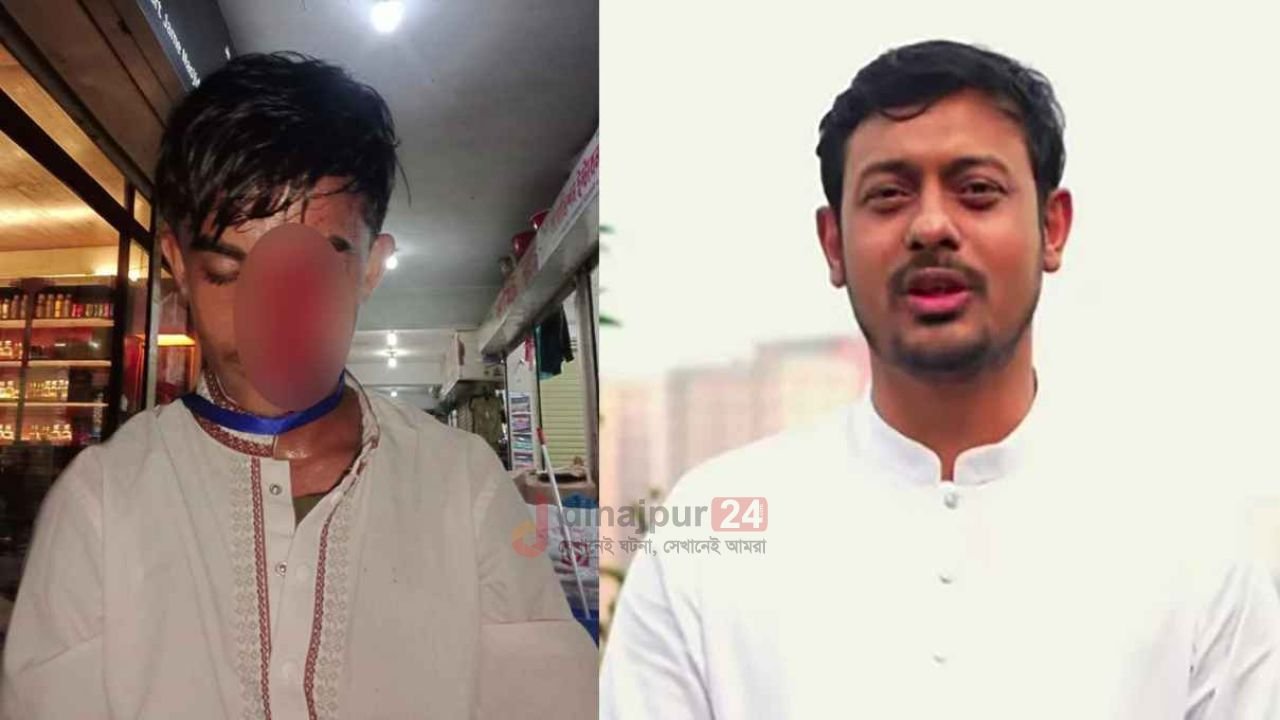 মাননীয় প্রধানমন্ত্রী, প্লিজ ছেলেটার চোখ ফিরিয়ে দিন: আর্জি পাটওয়ারীর